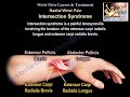 Wrist Pain Causes & Treatment  - Everything You Need To Know - Dr. Nabil Ebraheim