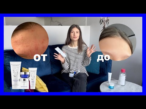 КАК Я ИЗБАВИЛАСЬ ОТ ПРЫЩЕЙ | вылечить ACNE | ZO SKIN by Zien Obagi