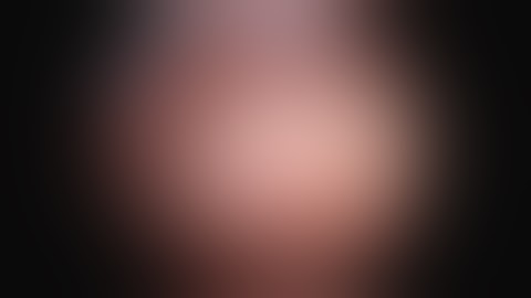 A New Technique for Patch Augmentation of Rotator Cuff Repairs