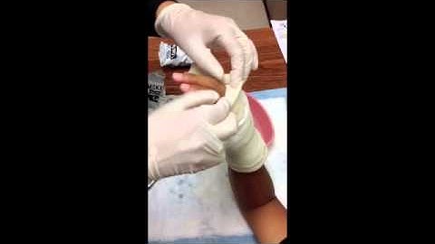How To Apply An Ulnar Gutter Cast