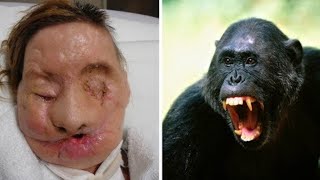 10 Animal Pets That Attacked Their Owner!