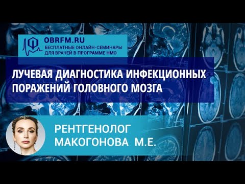 Video: Медицинада семиология эмнени билдирет?