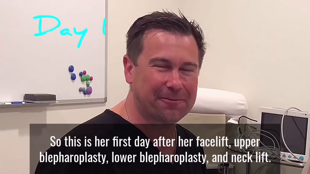 🦋 Margaret Josephs Facelift RHONJ Reunion Season 10 Dr Mark Karolak