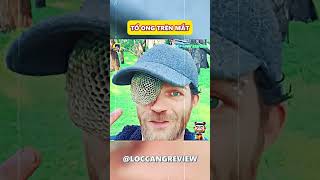 Tổ Ong Trên Mắt