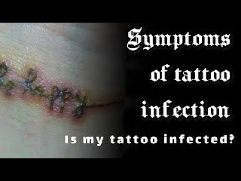 How To Know If Your Tattoo Is Infected | A Little Bit Of Everything