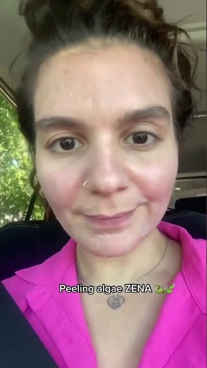 Result Zena Algae Peeling | Before and After