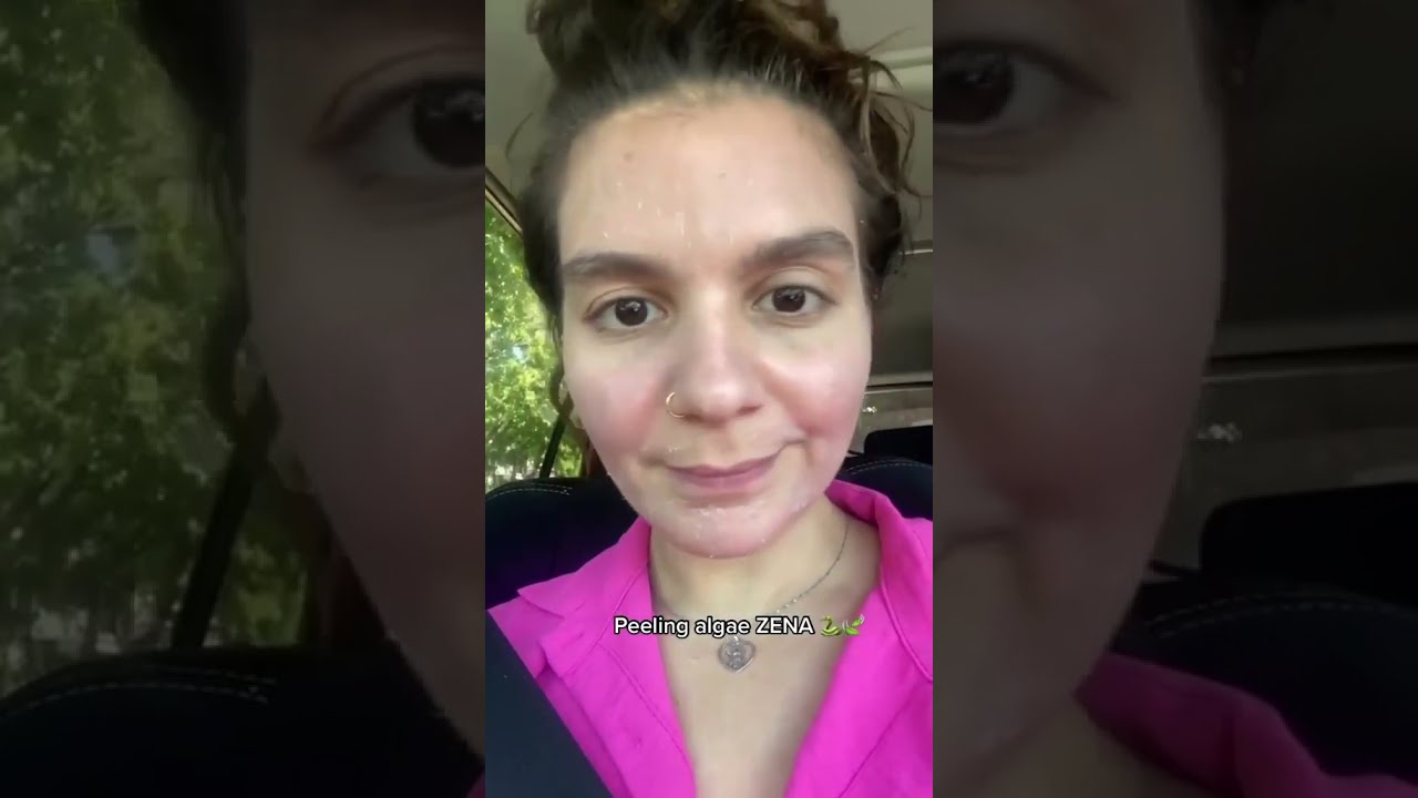Result Zena Algae Peeling | Before and After