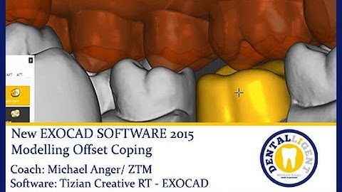EXOCAD SUPPORT TUTORAIL 2015 - Teaser - Modelling Offset Coping by Michael Anger
