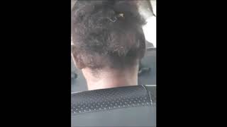 Roach Crawling In A Womans Hair While On A Bus