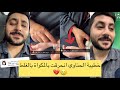 خطيبة الحناوي انحرقت بالمكواة بالغلط