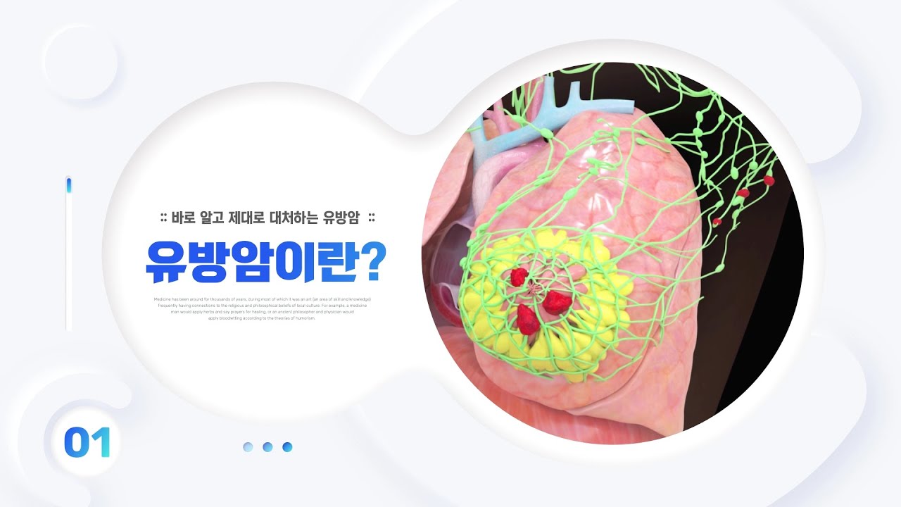 유방암 진단과 치료에 대한 최신 정보를 알려드립니다 | [바로 알고 제대로 대처하는 유방암]