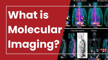 Molecular Imaging 101