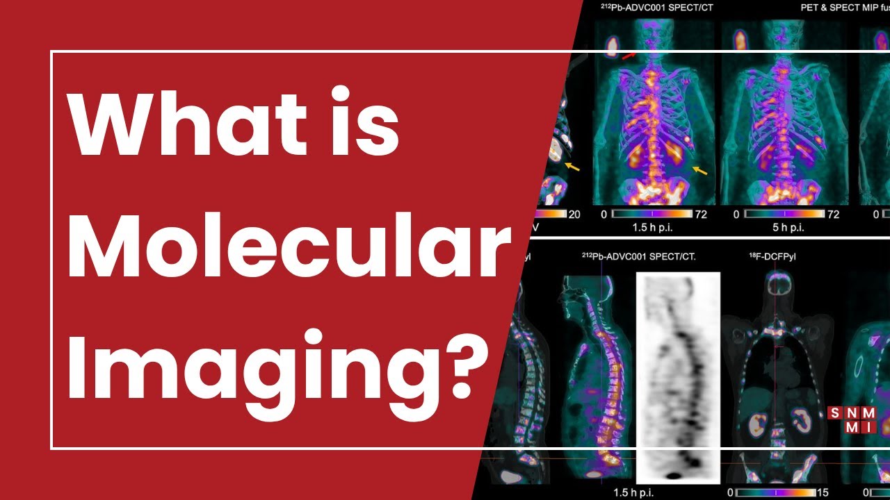 Molecular Imaging 101