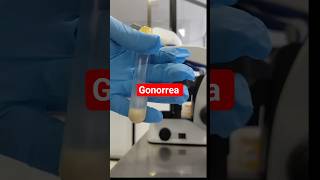 Gonorrea #datoscurisos #sabias #science #medico #microscope #embarazo #hindi #hombre