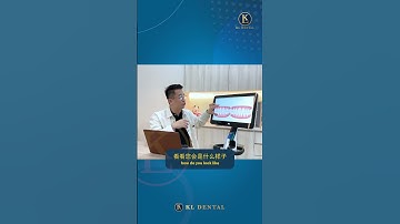 Exploring the Advancements of iTero Intraoral Scan