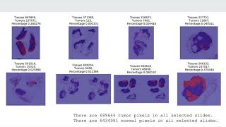 Masking Cancer Metastases on Gigapixel Pathology Images by Ruizhi Zhang