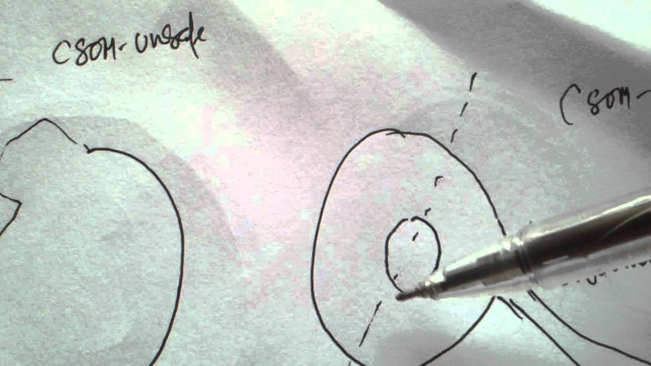 Differences between Ear Discharge of Safe and Unsafe Ears.