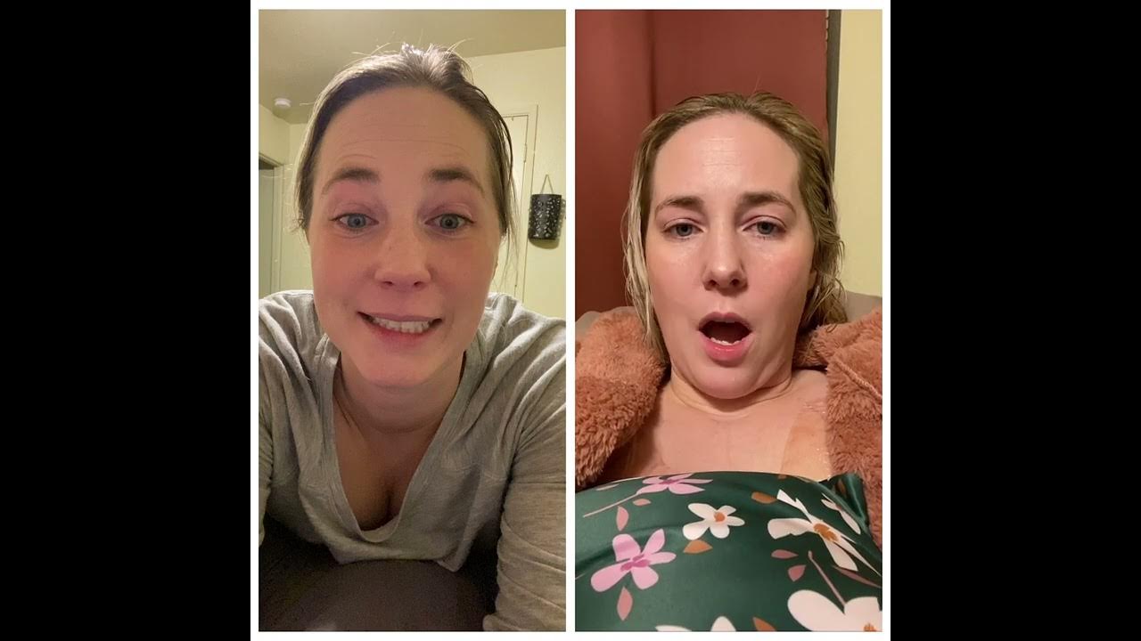 Surgery 1 Double Mastectomy with Tissue Expanders YouTube