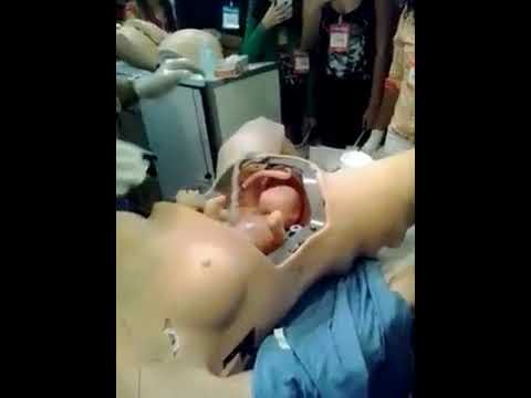 Professor explicado sobre parto normal - YouTube Instagram da fama