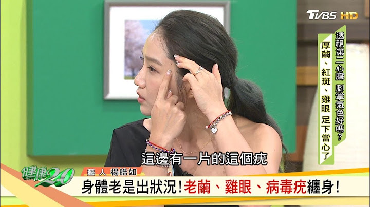 身體老是出狀況！老繭、雞眼、病毒疣纏身！ 健康2.0 - 天天要聞