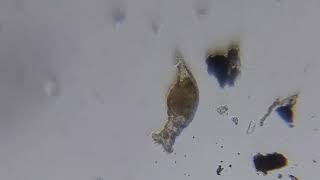 Rotifer filmed with smartphone and Blips Ultra Labkit