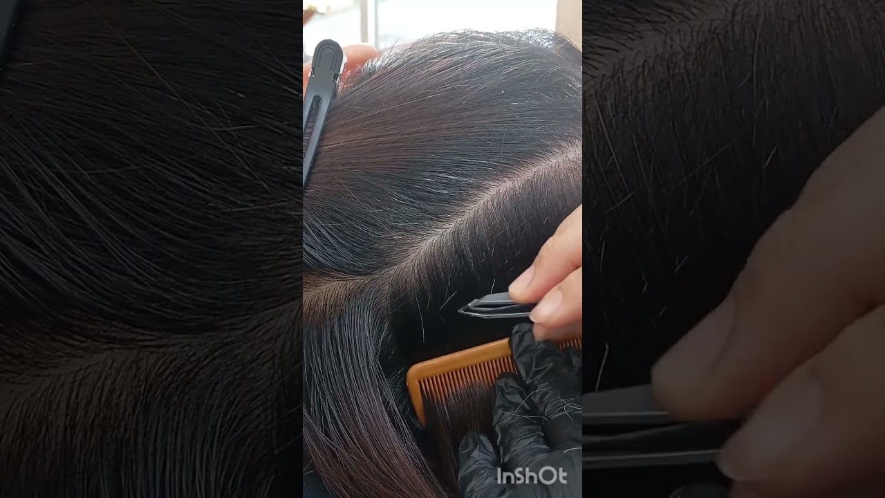 ทุกรูขุมขนจริงๆ#ถอนผมหงอก