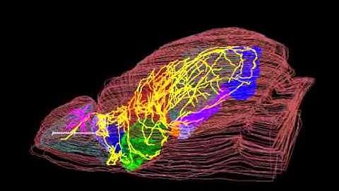 Single-cell visualization of a mitral cell in the mouse brain