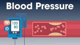 Why Blood Pressure Matters | Munson Minutes