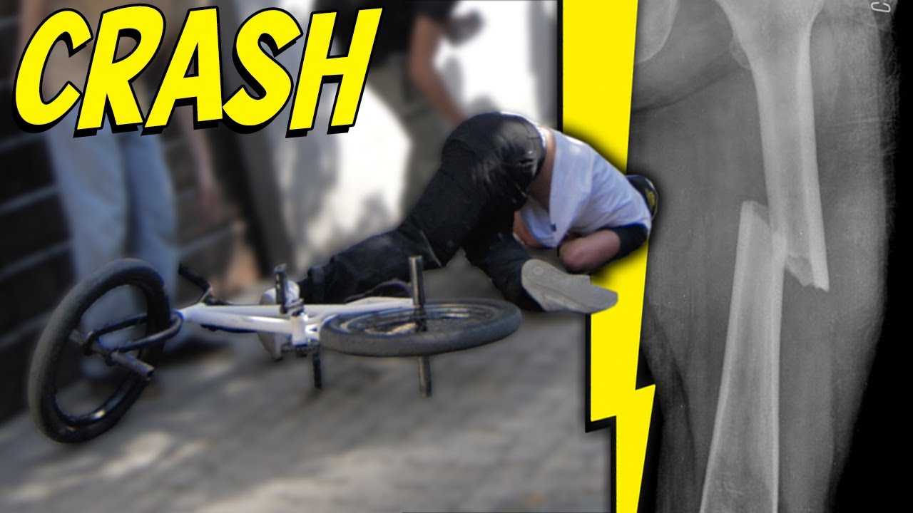 SI E' ROTTO LA GAMBA IN BMX!!! *no clickbait*
