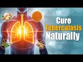 “Natural Cure for Tuberculosis | Boost Immunity & Heal Naturally | Health Diagnosis”