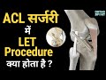 ACL Surgery मे LET Procedure क्या होता है ? Lateral Extra-Articular Tenodesis, Anterolateral Complex