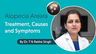 Alopecia Areata - Treatment, Causes and Symptoms by Dr. T N Rekha Singh