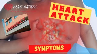 What are the symptoms of a heart attack?