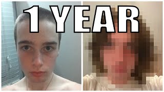 Daily Selfie for 1 YEAR (Hair Growth) screenshot 1