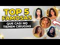 "¡No podrás creerlo! 5 famosas que casi NO han pasado por el quirófano"