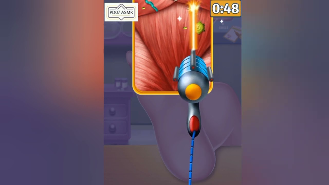 ASMR | Foot infection surgery | pedicure manicure callus toenails