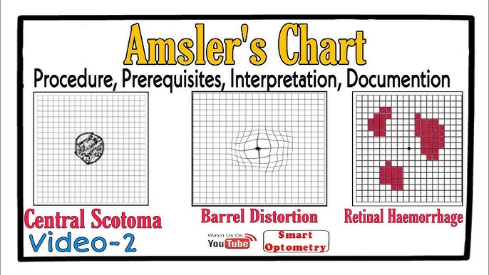 Eye Chart - 8.5 x 5.5, Amsler Grid Recording Pad