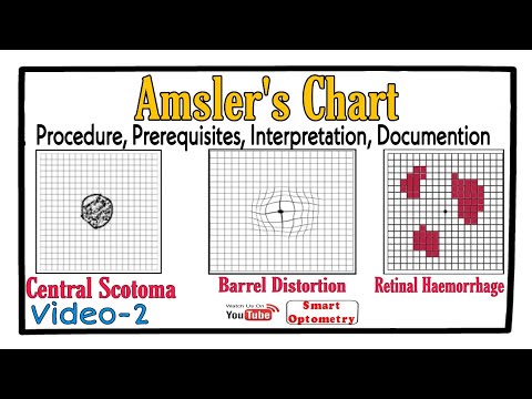 Amsler's Chart- Procedure, Prerequisites, Scotoma, Interpretation