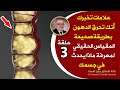 علامات إذا شعرت بها فأنت تحرق الدهون بشكل صحيح كل ما يتعلق بأسرار حرق الدهون ونقص الوزن ونسف الكرش 