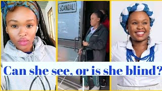 Is Thoriso from Scandal (Kamogelo Moree) blind in real life?