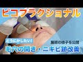 【施術動画】ピコフラクショナルレーザーで毛穴の開き、ニキビ跡の凹みを改善！