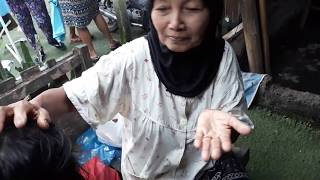 OMG She Eat the Head Lice ! Kutu Rambut Tumo | Lice Removal