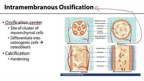 MSK Skeletal System Basics - Bone Formation