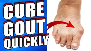 How To Get Rid of Gout Naturally in 24 HOURS screenshot 4
