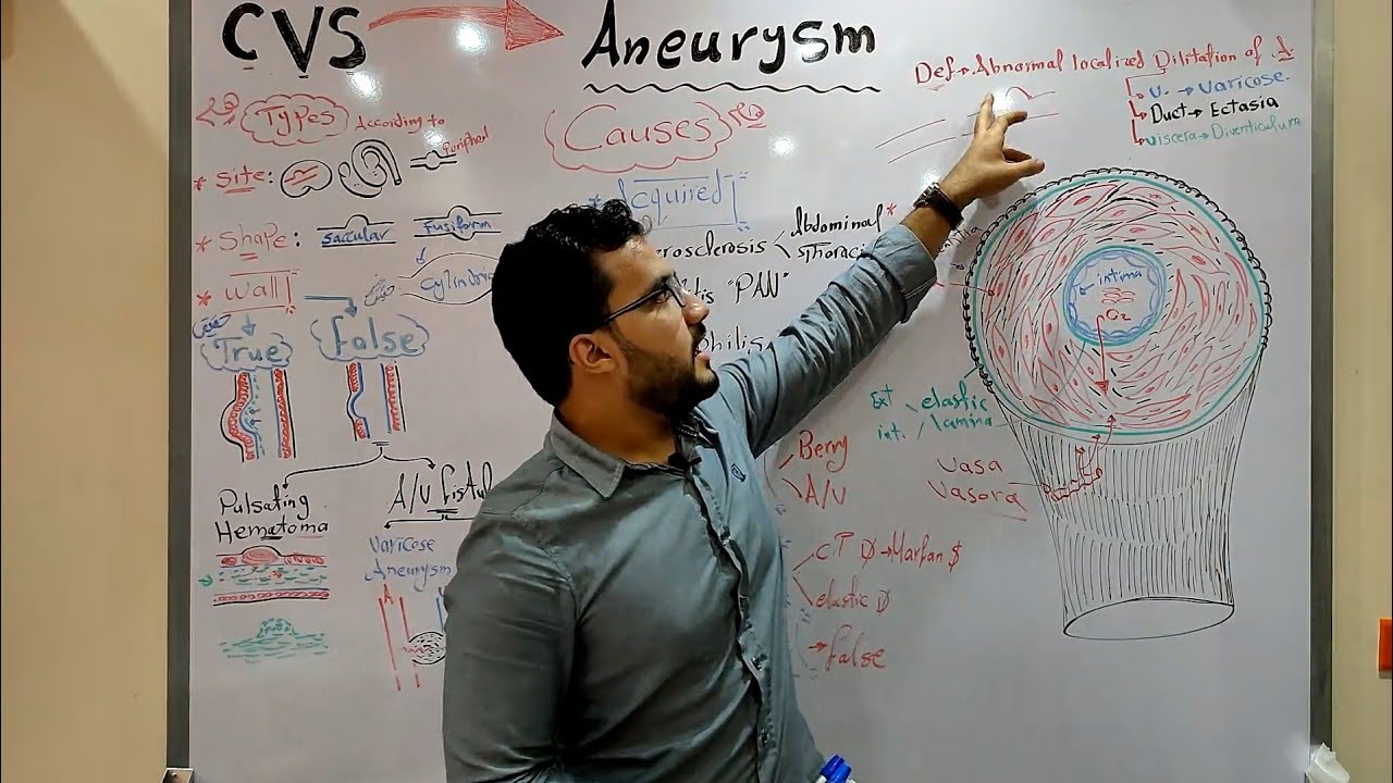 CVS module - Aneurysm (flipped)