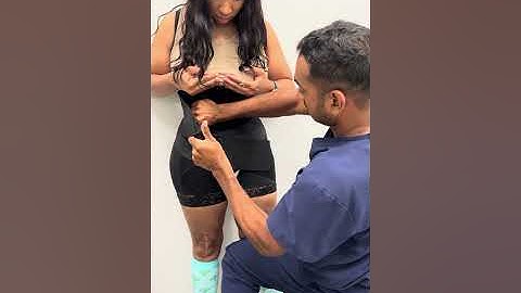 Our Surgery Compression Garment is the Coolest! must see