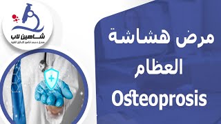 مرض هشاشة العظام: الأسباب والأعراض والتحاليل المطلوبة | Osteoporosis
