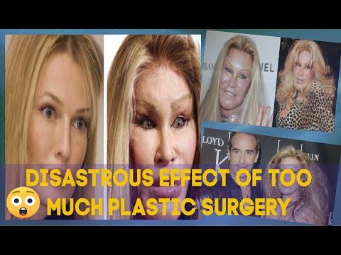 Video: The Reverse Side Of Plastic Surgery: 8 Terrifying Before And After Photos