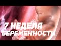 7 Неделя Беременности. Что Происходит с Мамой и Ребёнком ?