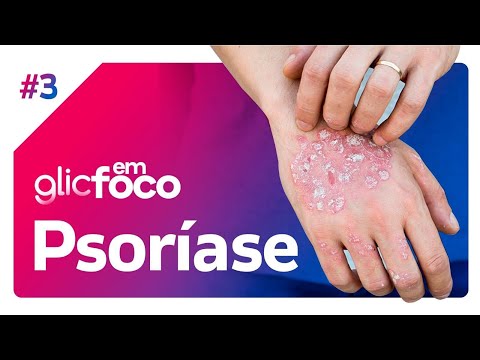 Psoríase | Glic em Foco #3